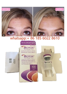 Allergan  Botulinum Toxin 100IU Anti-Wrinkles